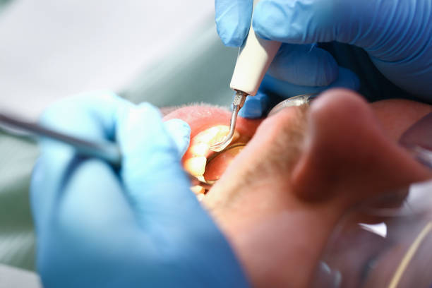 Best Knocked-Out Tooth Emergency  in Osage City, KS