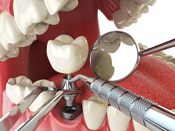 Best Tooth Pain Emergency Relief  in Osage City, KS